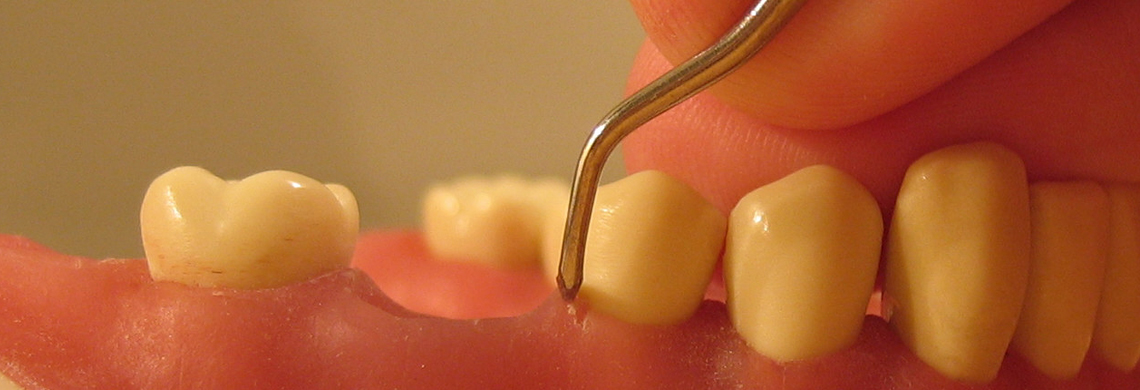 Advanced or Periodontal Procedures